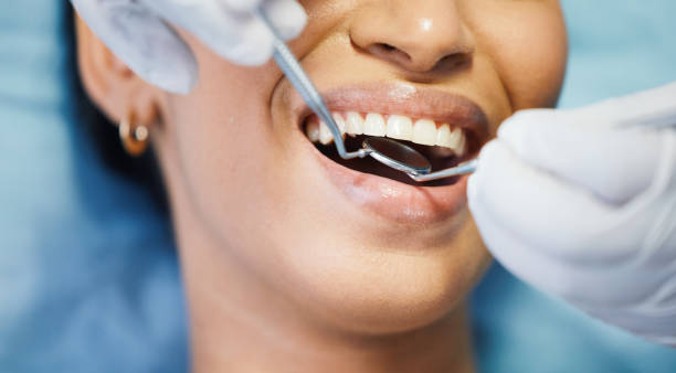 Best Walk-In Emergency Dentist in Middletown, MD